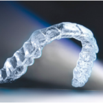 Si siente que aprieta los dientes en la noche consulte a su odontologo